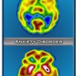 Anxiety Disorders: A Psychology Student’s Guide to Understanding a Complex Condition Anxiety Disorders